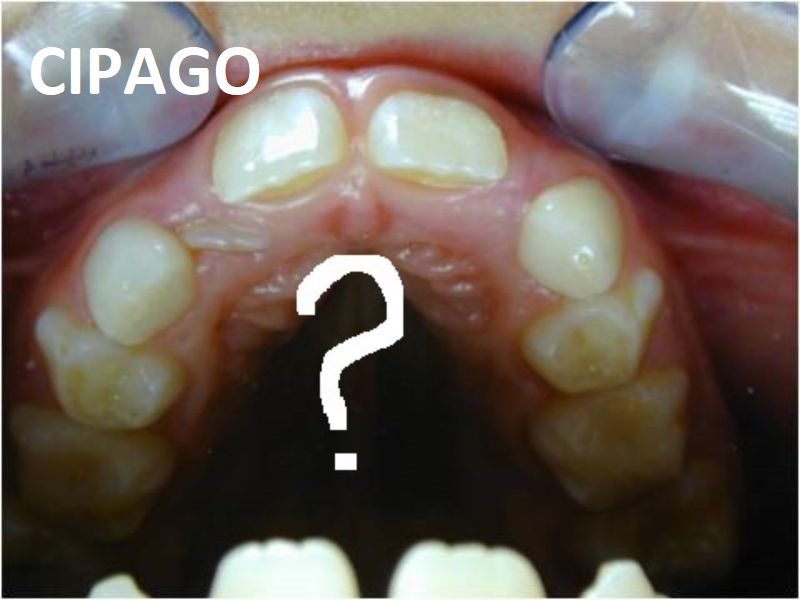 2000 – Tout ce que vous avez toujours voulu savoir sur l’orthodontie sans jamais oser le demander !