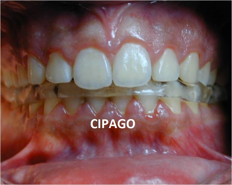 2001 – Orthodontie et Occlusodontie