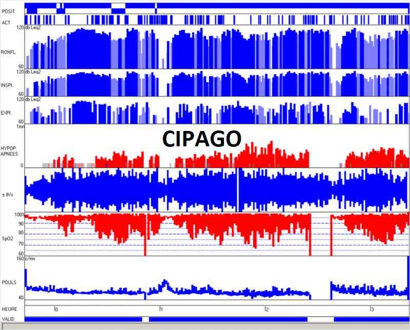 2004 – Pathologies respiratoires du sommeil et rôle du chirurgien-dentiste dans l’équipe interdisciplinaire