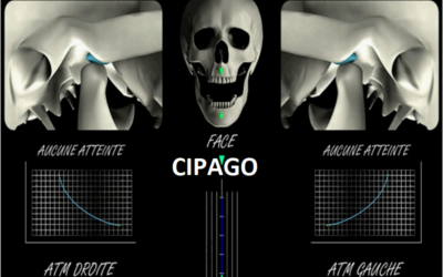 2010 – Traitement des dysfonctionnements temporo-mandibulaires par protocoles synergiques gouttières / chaînes musculaires