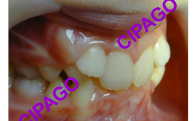 2018 – Orthodontie : CAP sur la prévention