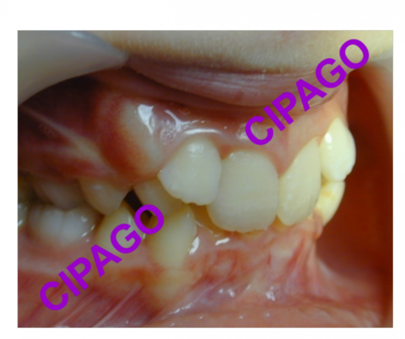 2018 – Orthodontie : CAP sur la prévention